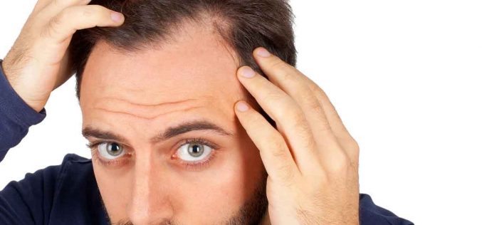What are the Myths & Facts Associated with the Hair Transplantation