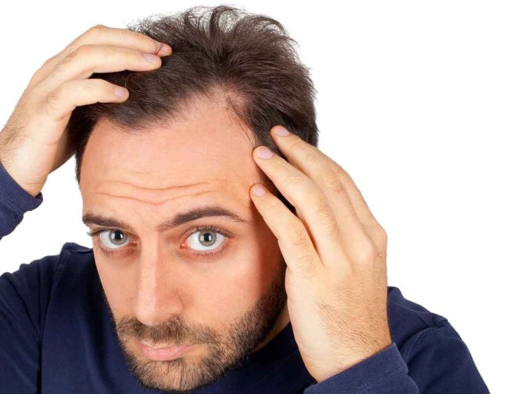What are the Myths & Facts Associated with the Hair Transplantation