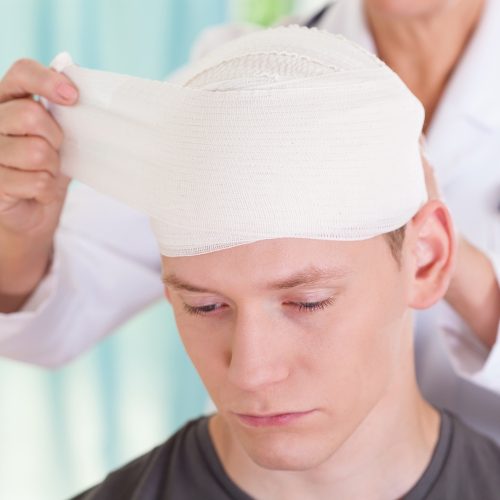 Traumatic Brain Injuries in your Workplace: Here is what you need to know