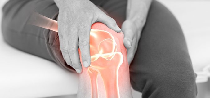 Gonarthrosis Or Osteoarthritis Of The Knee