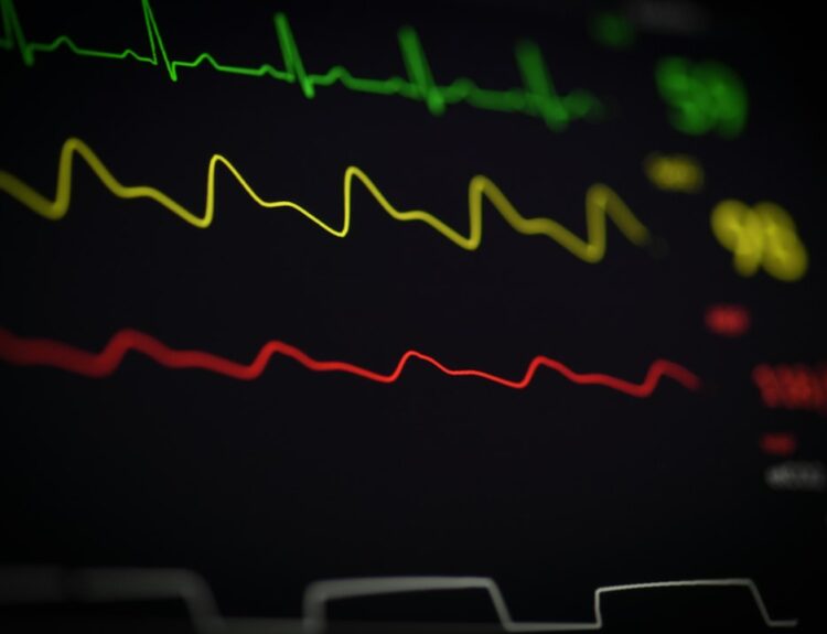 Close-up of a heartbeat monitor displaying colorful ECG readings