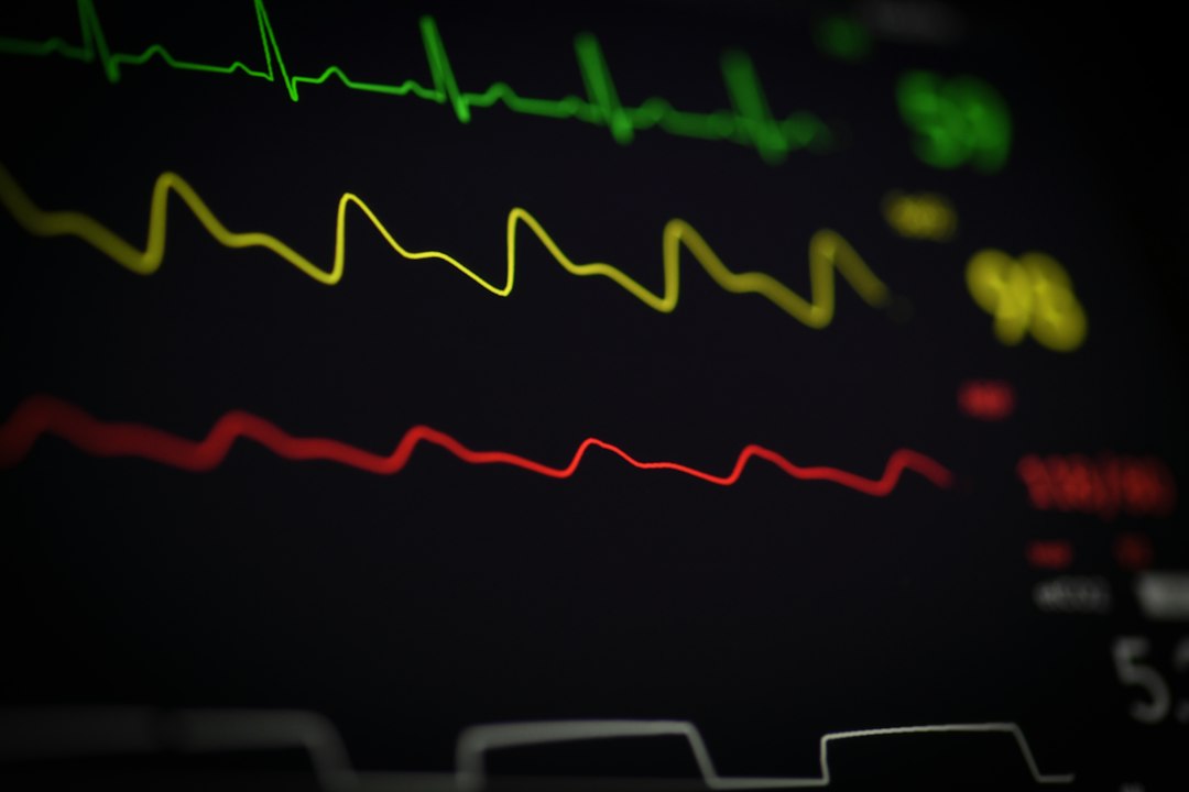 Close-up of a heartbeat monitor displaying colorful ECG readings